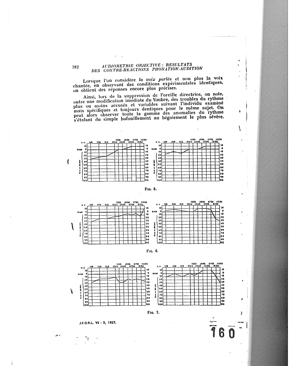 Fig. 5, Fig. 6 e Fig. 7 — Serie audiometriche comparative che illustrano le anom